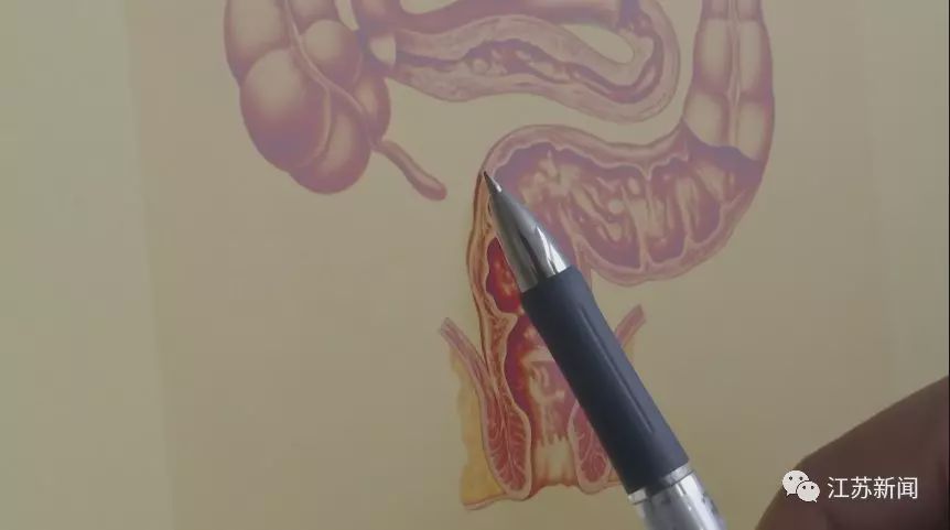 12岁男孩澡堂滑倒,12岁男孩厕所滑倒