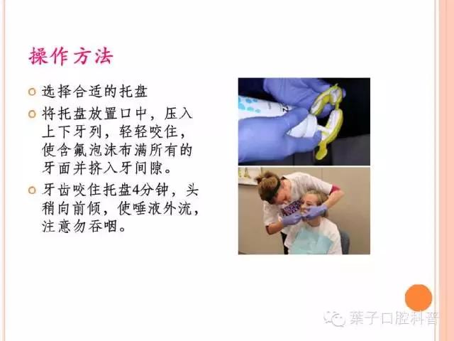 牙齿涂氟小知识,有氟牙可以涂氟吗