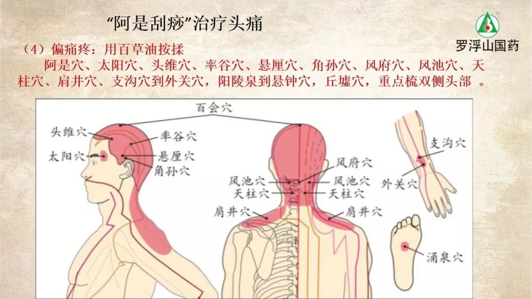 头痛刮痧后就不痛了是什么原因,感冒头痛刮痧快速缓解