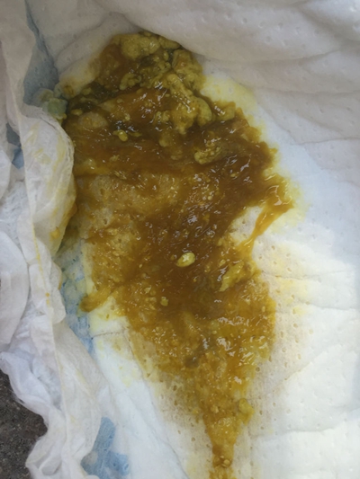 宝宝无缘无故哭闹是冷处理还是哄,宝宝晚上哭闹需不需要就医