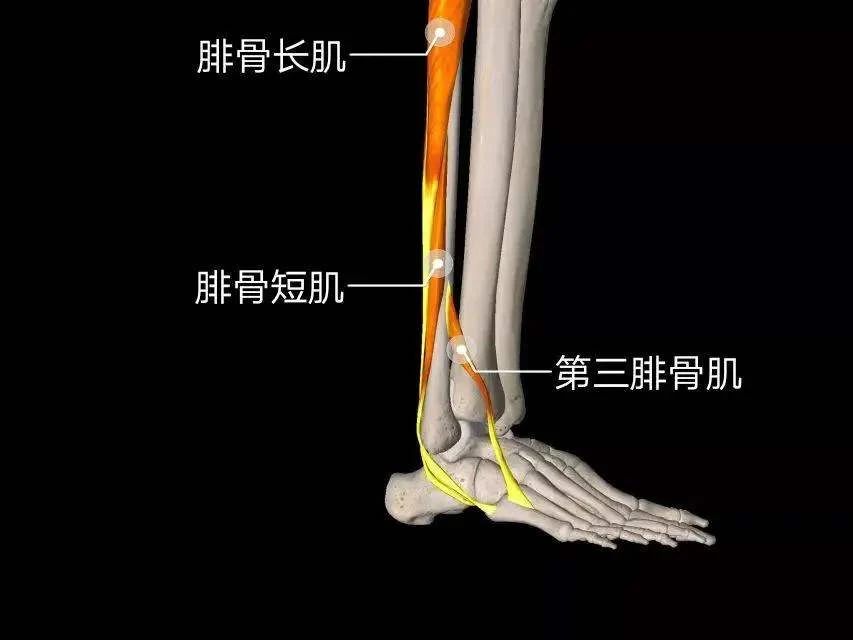 小腿肌肉外翻和膝盖内扣一样吗,小腿肌肉外翻骨头是弯的