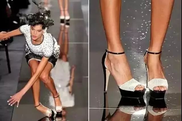 崴脚变成习惯性崴脚,习惯性崴脚的小妙招