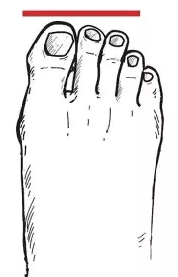 脚型不好看不敢穿凉鞋怎么办,什么脚型适合穿什么高跟凉鞋