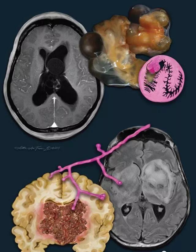 用错驱虫药=给孩子“下毒”