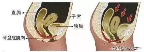 产前盆底肌训练运动,顺产几天后可以做盆底肌修复操