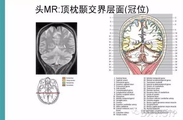 mra头颅解剖学详细讲解视频,常见的头颅mri图像