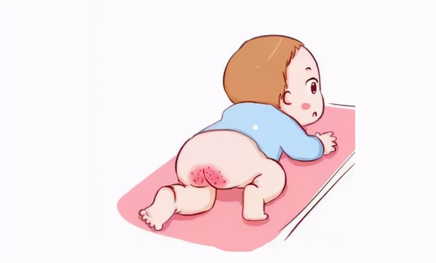 美力源育儿讲堂：宝宝总是会出现红屁股怎么办