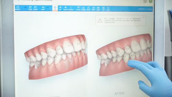 青岛优诺口腔牙齿正畸怎么样,青岛市南区优诺正畸专家