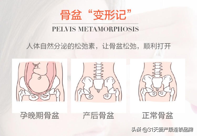 产后满月发汗及骨盆修复有必要吗,产后满月恢复
