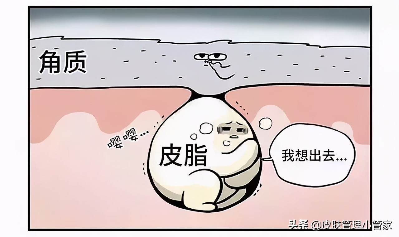 祛斑祛痘皮肤管理,皮肤管理祛痘有效吗