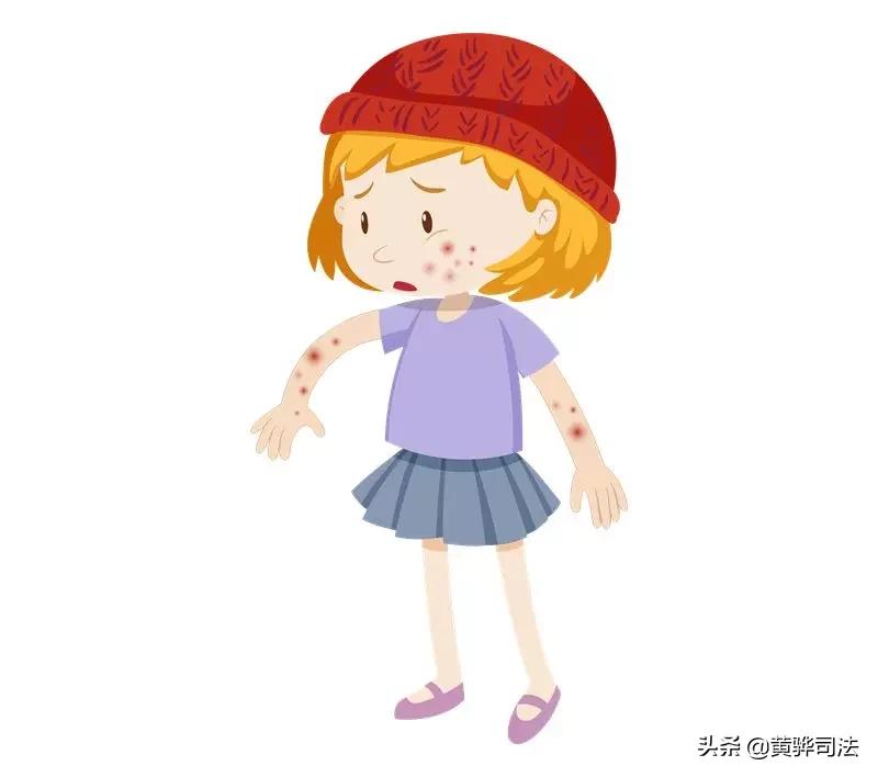 水痘高发季怎样做才能避免中招,水痘高发期预防关注事项