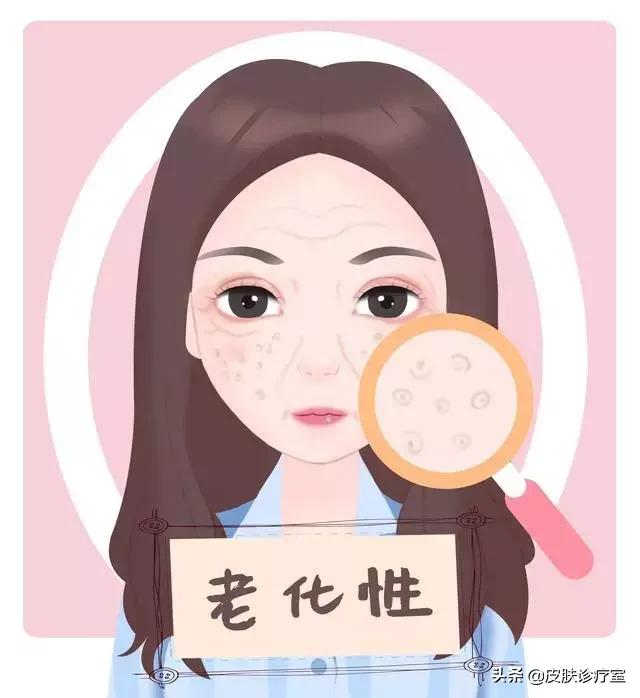 女生毛孔粗大全脸,90岁女人毛孔粗怎么办