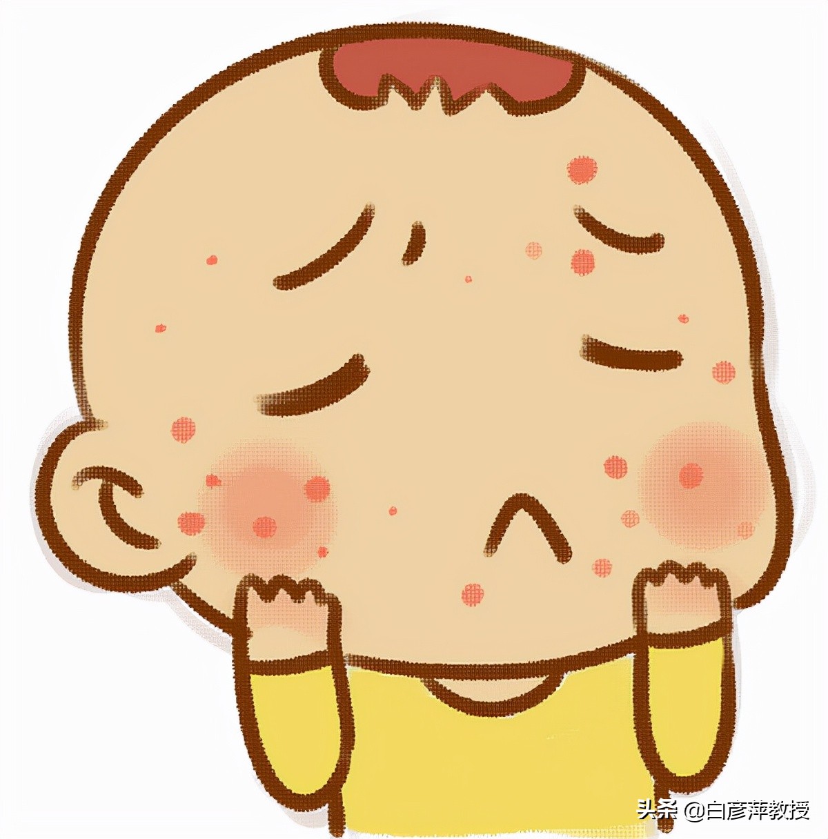 红疹与麻疹的区别,红疹与风团的区别