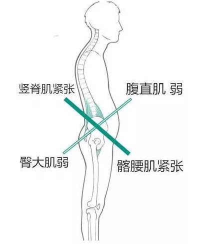 左右肌肉不平衡,肌肉不平衡怎么矫正