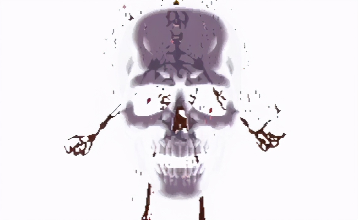 拳皇卢卡尔精彩视频,拳皇卢卡尔全部形态