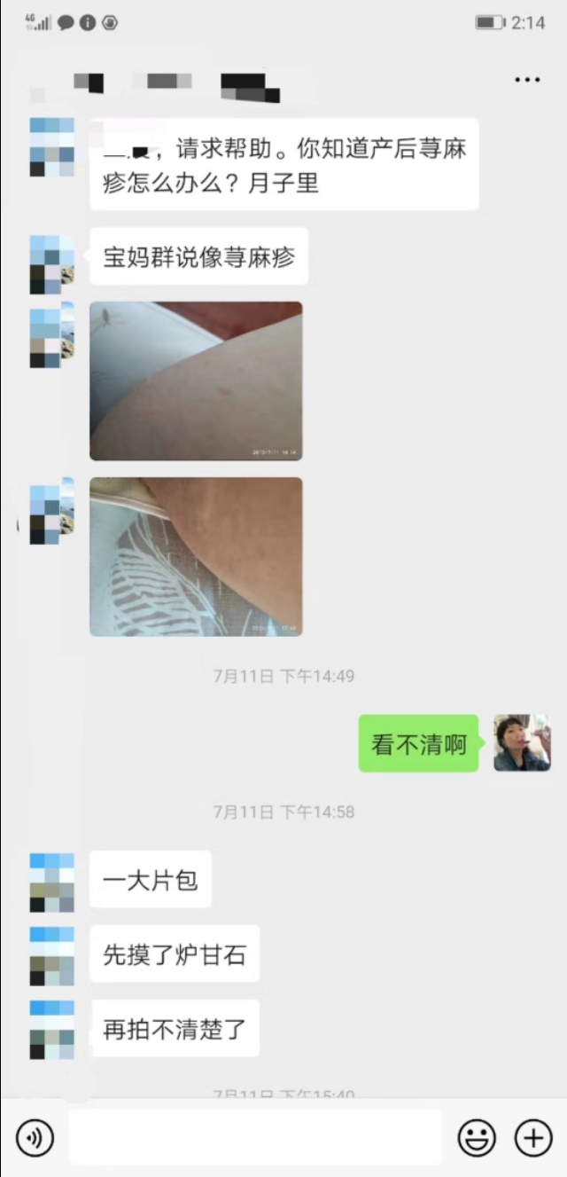 婴幼儿麻疹,儿童病毒性麻疹