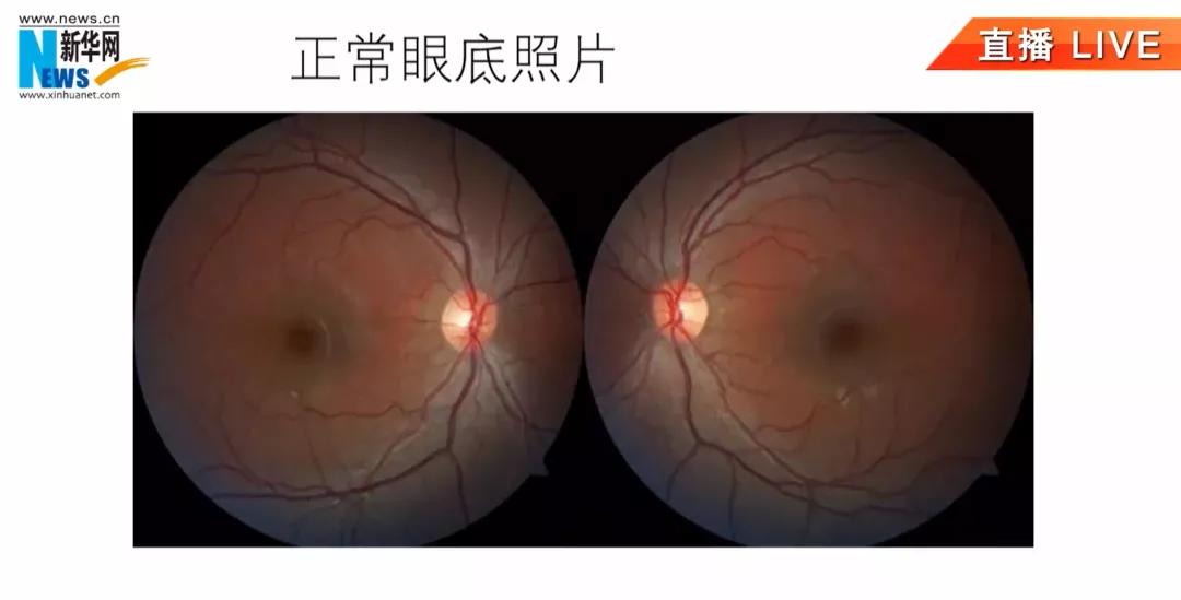 小孩假近视家长怎么办,孩子近视家长怎么调整心态