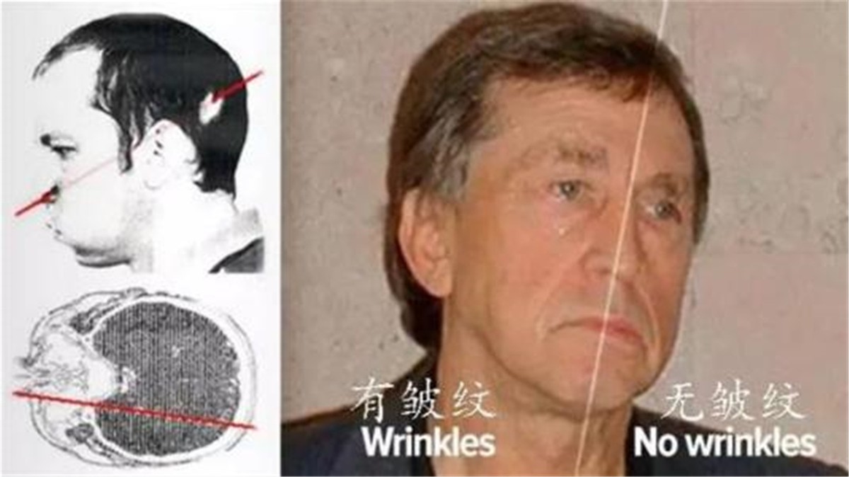 他把头伸进粒子加速器，被接近光速的质子束“轰击”，最后怎样了