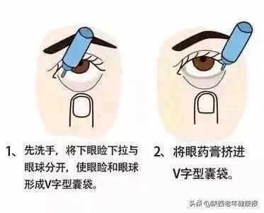 手术后伤口消毒用酒精还是碘伏,眼睛做了手术后可以用碘伏消毒么