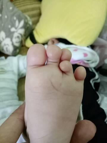 脚正不怕鞋歪什么意思,孩子穿什么鞋不会显脚变形