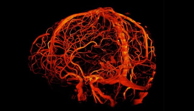 x射线下的人体图,x射线照片