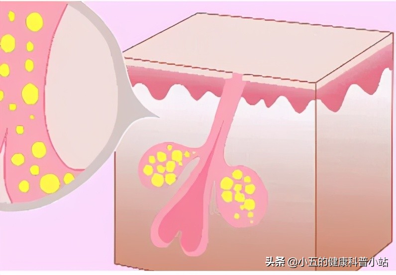 老人身上有味道是因为不洗澡吗,老年人身体的老人味消失了好吗