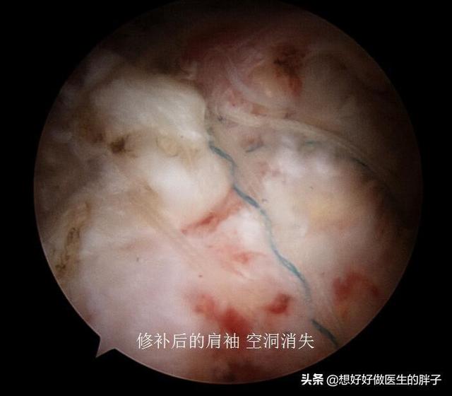 左侧肩膀疼痛预示十种病,哪些病可引起肩膀痛后背痛颈椎痛