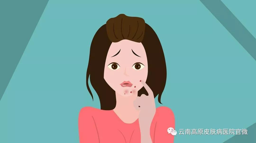 脸上老是长*疮痤**，还一直不好？别急，里面有妙招解决