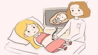 钟晓芹胎停什么意思,钟晓芹医院检查胎停