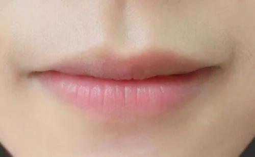40多天宝宝便血,纯母乳宝宝便血是怎么回事