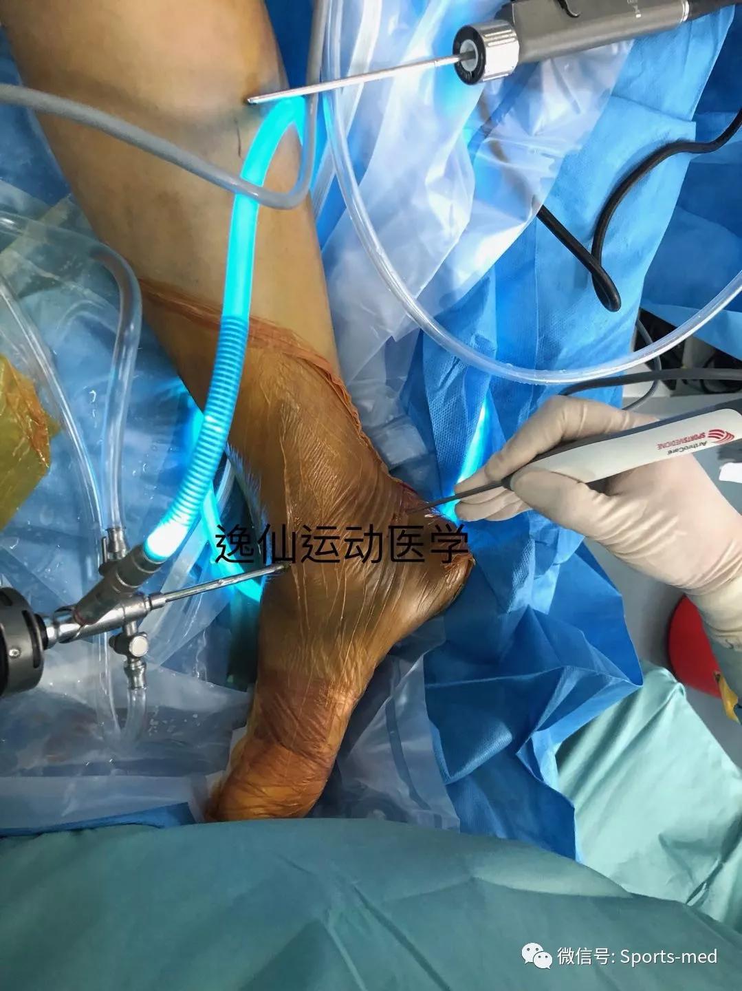 涓嶅ソ鎯圭殑浜虹殑涓夊ぇ鐗圭偣,涓夎闊у甫鎷夐暱