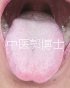 大便次数多经方治疗,大便次数多能用四联疗法吗