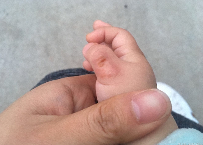 什么时候开始让宝宝光脚,宝宝光脚会有什么坏处