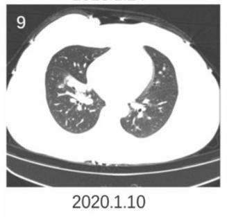 磨玻璃阴影怎么处理,磨玻璃阴影