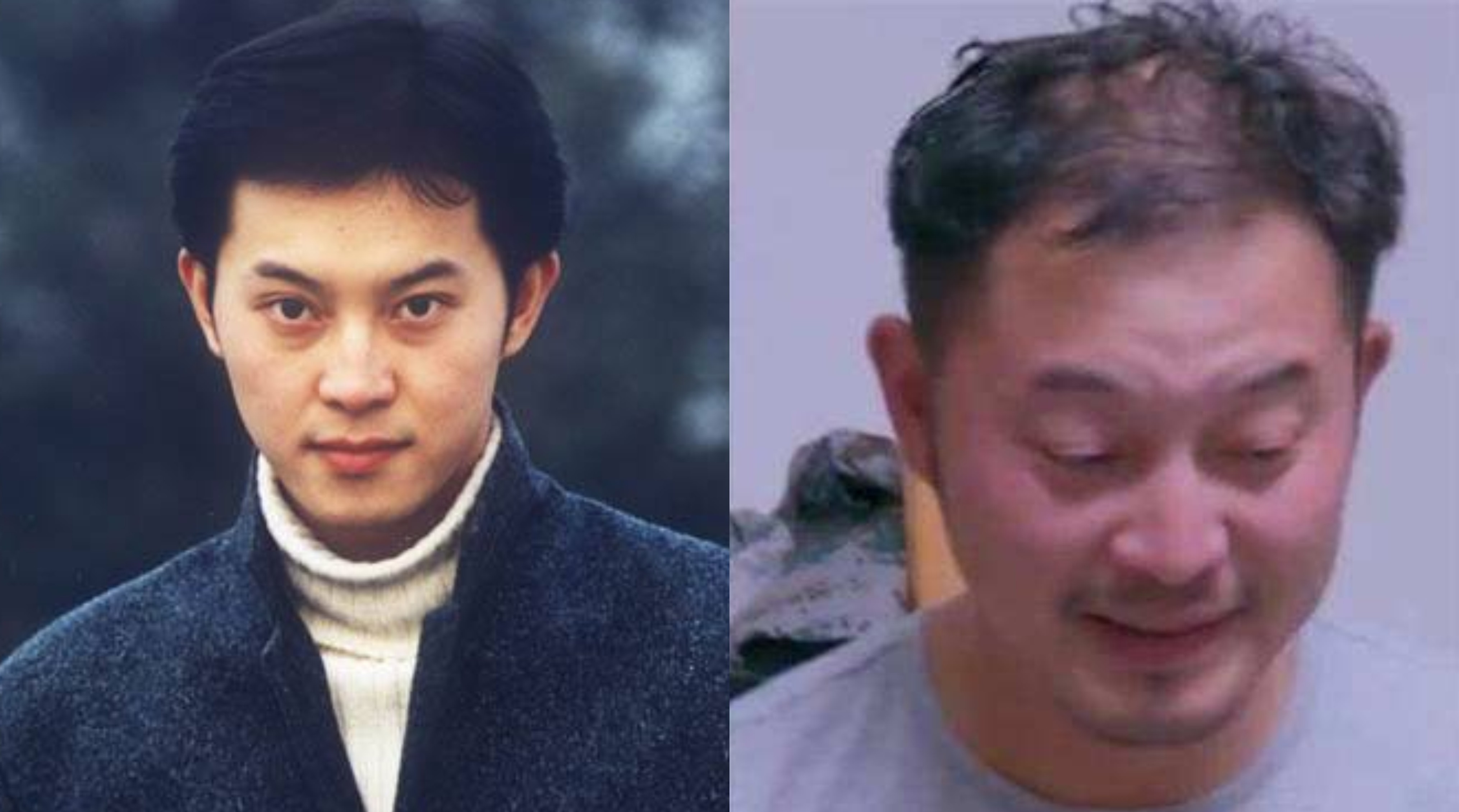 m型脱发也帅的男明星,帅气也挡不住脱发的10位男明星