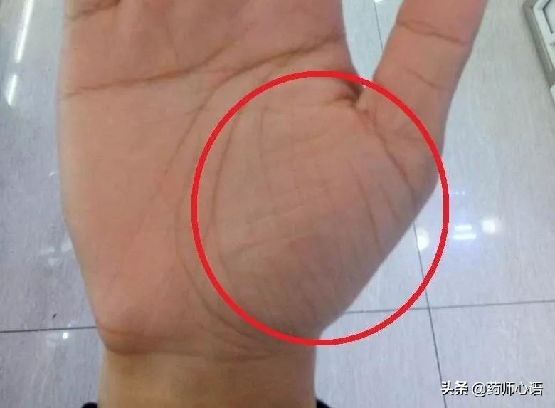 手上的健康秘密,手的颜色能看出健康的问题吗