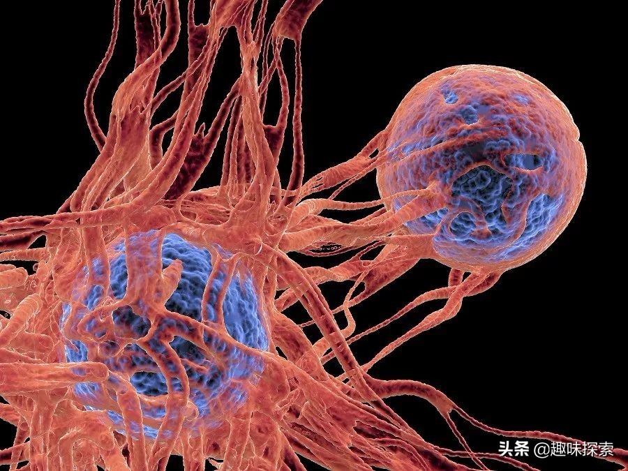 以色列专家称：治疗癌症已取得重大突破，几周就可以彻底治愈