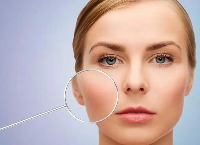 出油毛孔粗大闭口黑头怎么治,脸上有黑头毛孔粗湿敷