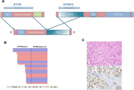 乱补雌激素引发乳腺癌,补雌激素能导致乳腺癌吗