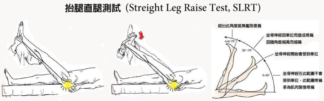 久坐屁股外侧酸痛的缓解方法,久坐后屁股很酸