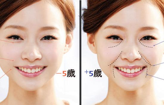 法令纹去皱纹最好的方法,法令纹去皱纹最有效的方法