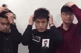 这里的毛毛千万别乱拔！谨慎会有生命危险