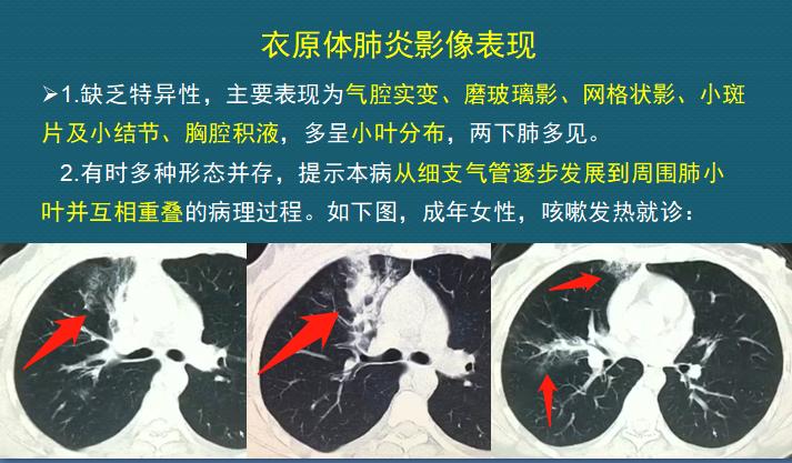 年轻人参观养鸡场，一个动作让他住院20天，损失3万块
