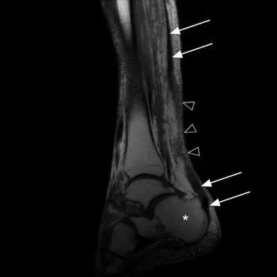 猛于虎伤病季后赛,勇士对猛龙汤普森受伤片段