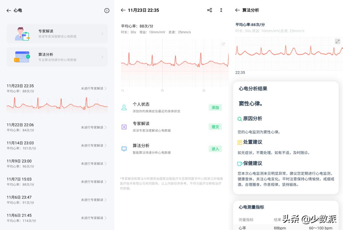 从一份体检报告说起：聊聊我与OPPOWatch的三种角色