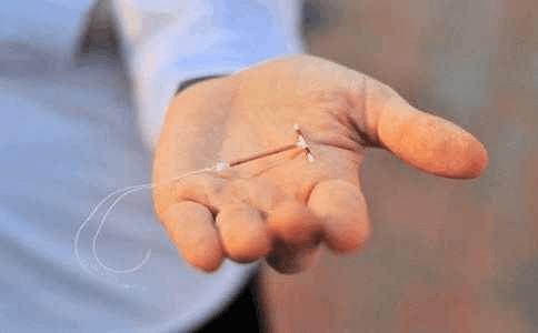 带“节育环”的女性，到了这个时候要取下来，别让自己活受罪