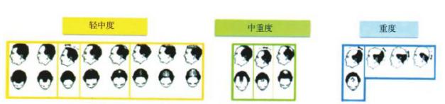 生酮饮食脱发严重怎么办,雄激素性脱发饮食关注什么