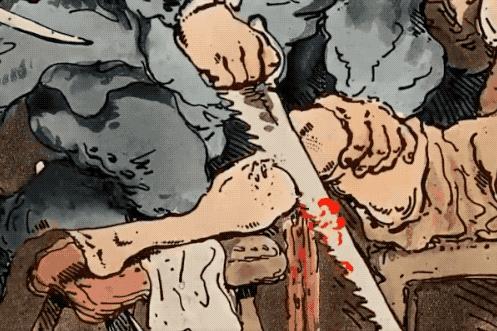 涓浗鍙や唬鍖诲鎵嬫湳,鍙や唬鍖诲鎵嬫湳