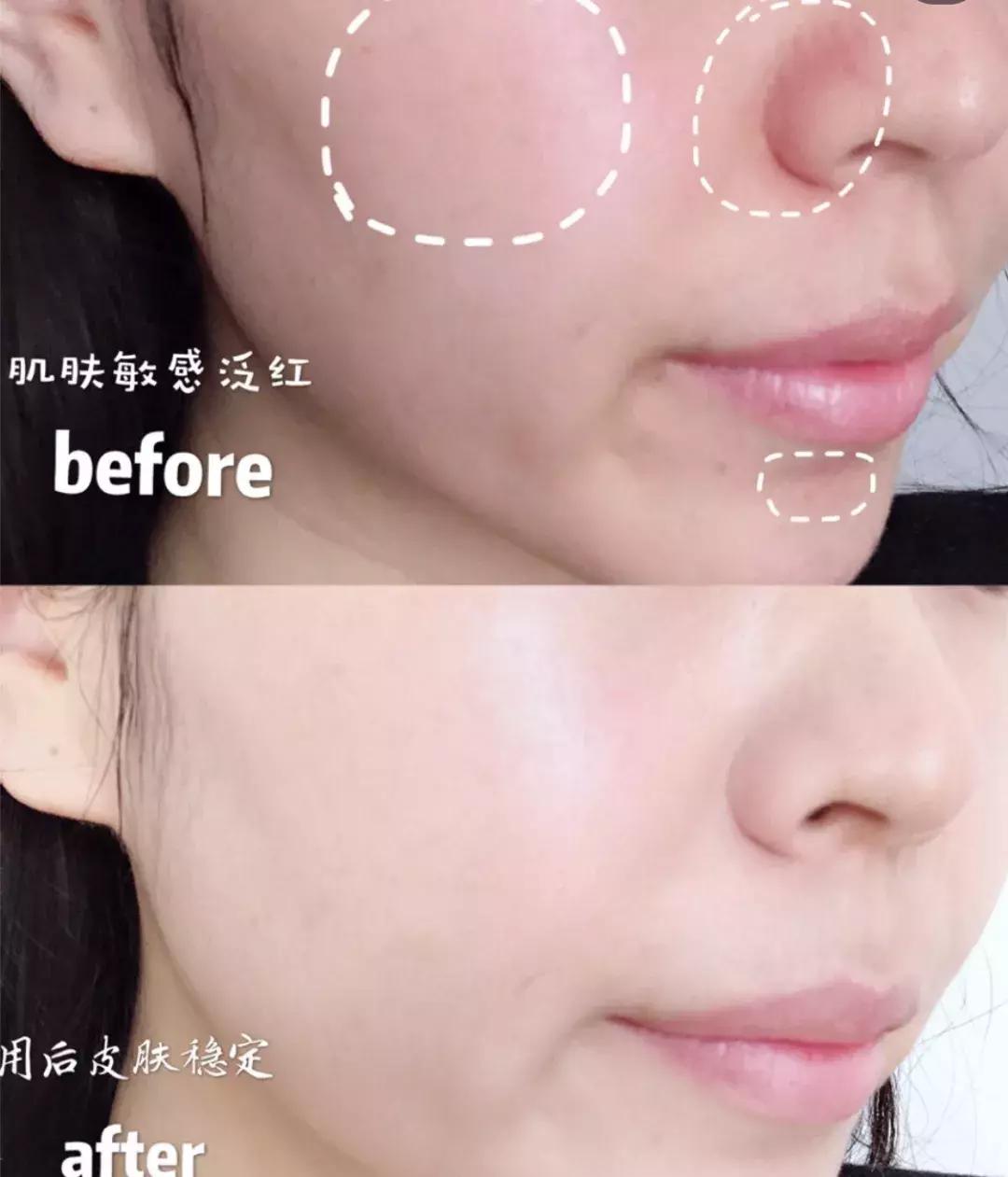 在家就能做的面部spa,在家可以做脸部spa吗