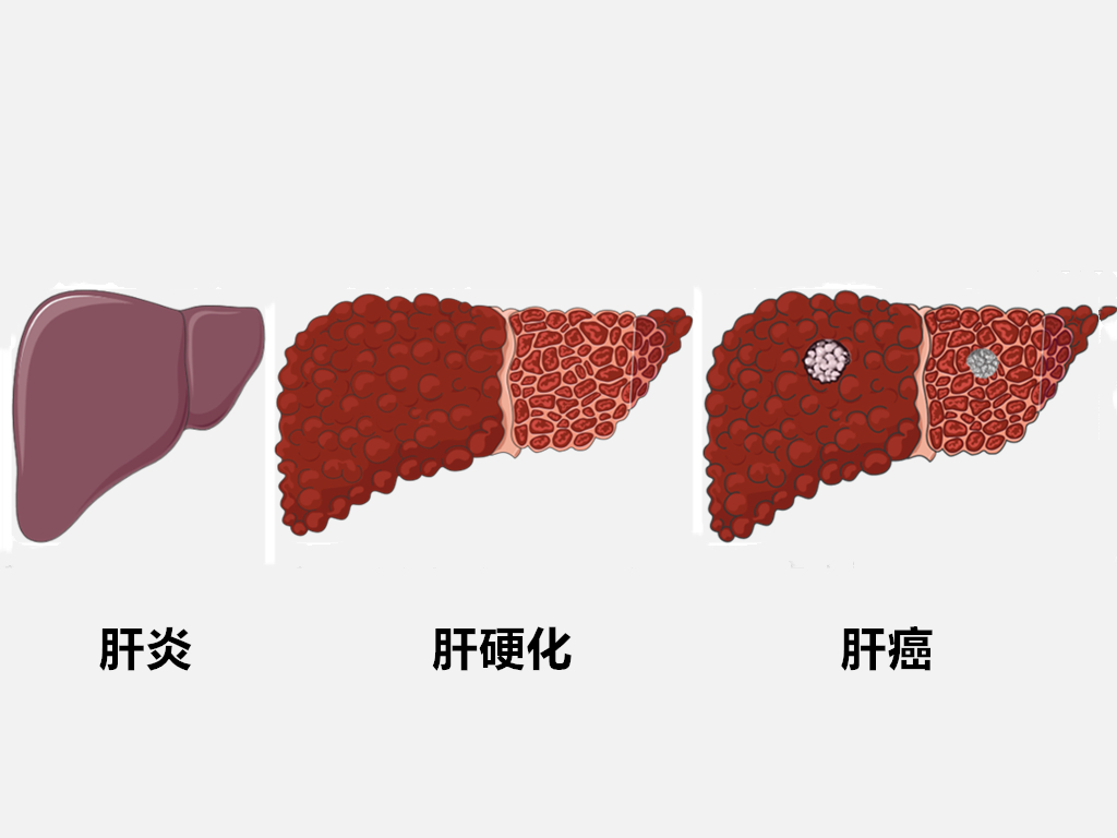 儿童肝功能异常的表现,怀孕肝功能异常怎么办